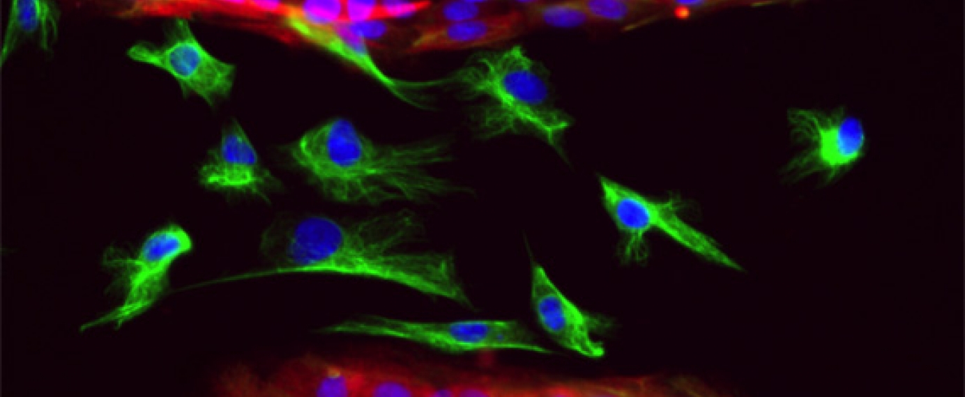 Microscopy of epithelial and mesenchymal cells